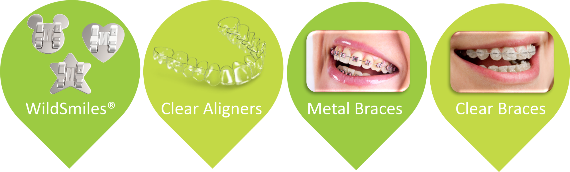 Types of Braces - Spring Pediatric Dentistry & Orthodontics